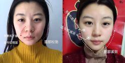 -上海伊莱美医疗美容医院