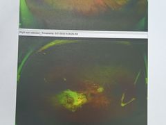 -大连何氏眼科医院