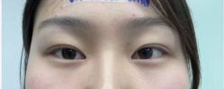 -素美医疗美容·西南眼鼻整形·修复基地