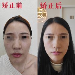 -颜和骨正·明哲式骨相美学整骨