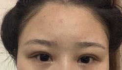 -长沙雅美医疗美容医院