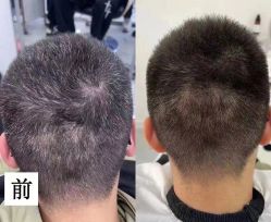 -舒欣头疗·俏丝谧语 白发脱发专业护理 