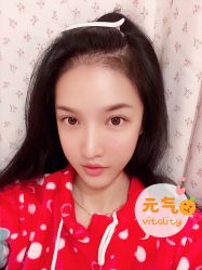 -大麦微针植发全国连锁