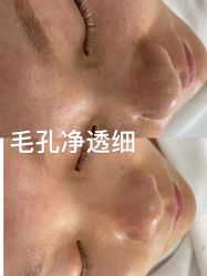 -凡碧诗毛孔清洁收细
