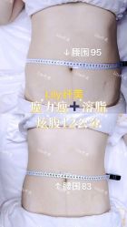 -Lily纤美·科技减脂中心