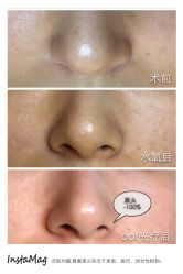 脸部抗衰-光SPA科技美肤