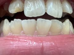 -极光口腔·矫正种植修复(锦江院区)