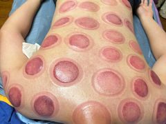 -沈师傅盲人按摩工作室(密三小区店)