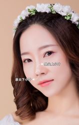 -北京米扬丽格医疗美容·联合丽格鼻整形中心