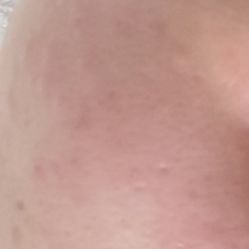 体验前-武汉颜范薇美医疗美容门诊部