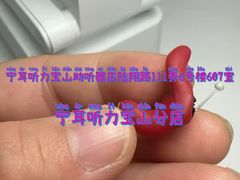 -宁耳听力助听器奥迪康·峰力·西门子(宝山店)