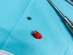 -广州市红十字会医院(总院)