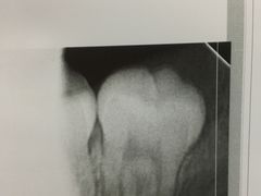 -上海市杨浦区牙病防治所