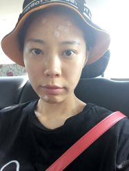 -苗方清颜专业祛痘连锁机构