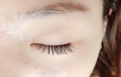 -宥莉·ULLY 痘敏肌•科技皮肤管理中心