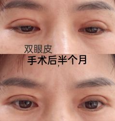 点击看大图 -深圳阳光医疗美容医院·旗舰店
