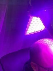 -碧莲盛·不剃发植发