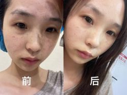 -坤如玛丽·医疗美容中心