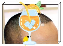 -大麦微针植发全国连锁