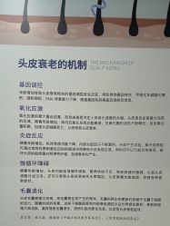 -碧莲盛不剃发植发