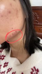 -广州美莱医疗美容医院