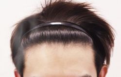 -大麦微针植发丨全国连锁