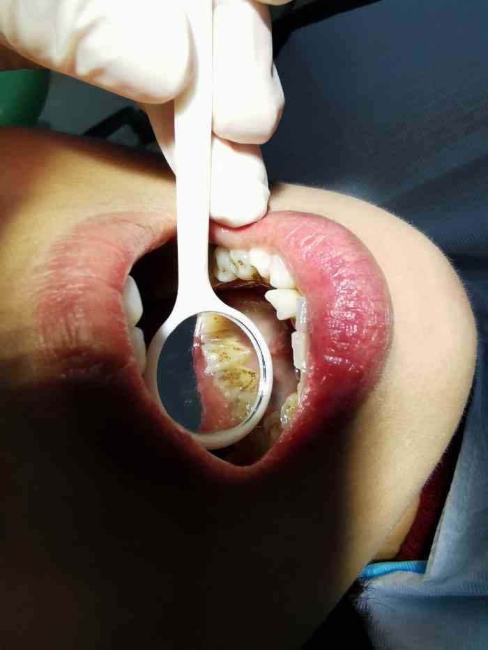 卓越口腔-"【项目】儿童齿科带小朋友拔牙齿,态度非."-大众点评移动版