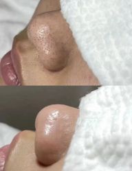 -美愈美肤MEIYU SKIN