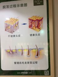 -丝客富脱发养发头皮馆