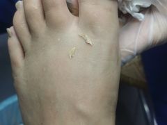 -世龙世家甲沟炎·灰指甲·嵌甲矫正·修脚(武侯区双楠店)