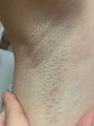 -玉笙美肤·专业脱毛中心