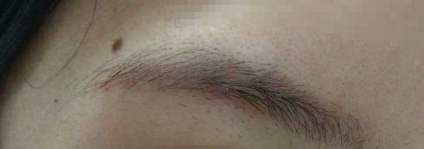 -伊丽莎白医疗美容