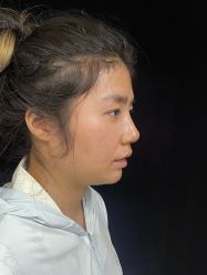 -杭州美莱医疗美容医院