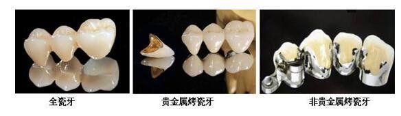 -团圆口腔·种植中心(锦江院区)