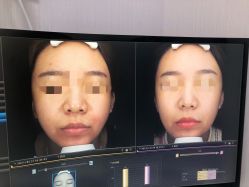 -北京楚诺医疗美容