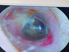 -溥耳·可视采耳·头疗·沐眼