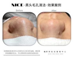-唯奈斯肌肤管理中心