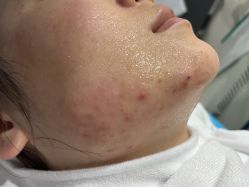 体验后-上海漾颜医疗美容