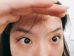 体验后-深圳春天阳光医院·轮廓抗衰中心