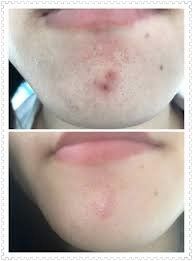 -SKINIST丽铂医疗美容