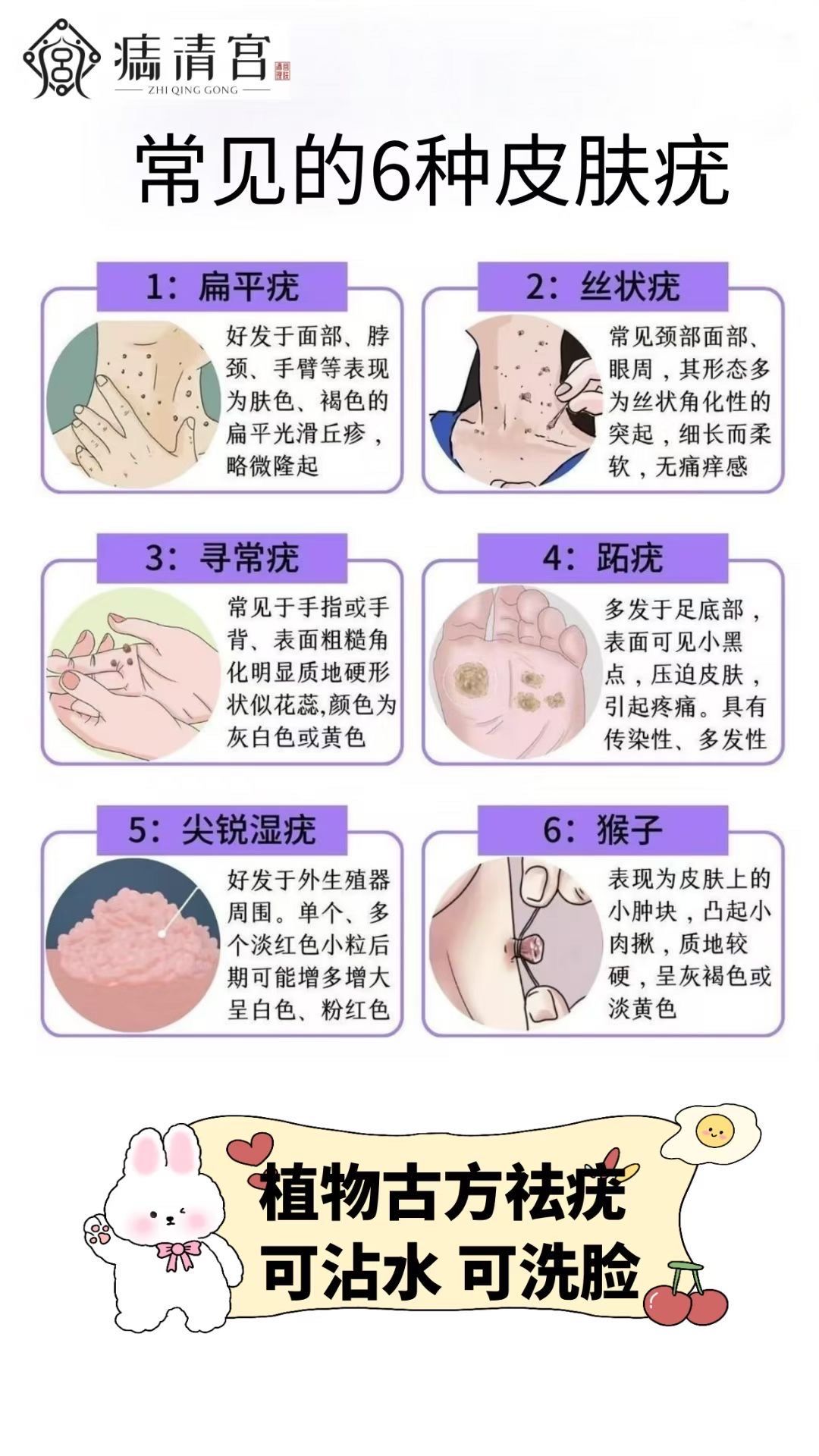 痣清宫:纯中药透皮技术专业祛除,大肉痣