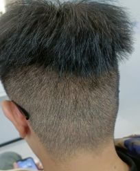 -大麦微针植发丨全国连锁