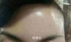 体验后-美莱医学美容医院