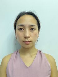 -四川米兰柏羽医学美容医院