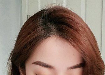 -大麦微针植发全国连锁