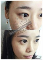 -YooMee优美智能科技美肤机构