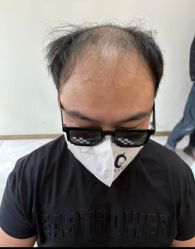 -唐风采假发补发定制