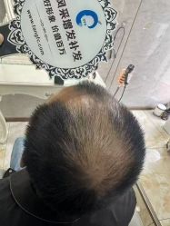 -唐风采假发补发定制