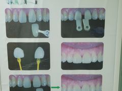 -杭州市第三人民医院