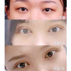 -美莱医学美容医院